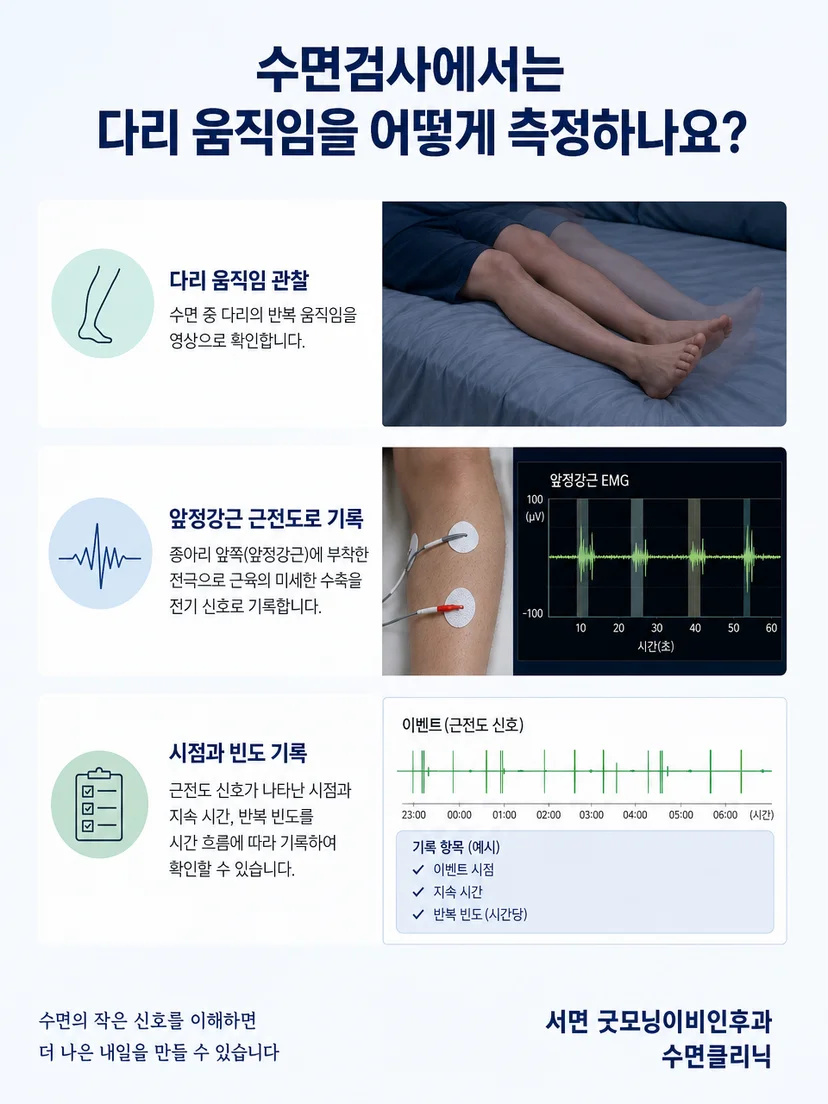 수면검사에서 다리 근전도와 다른 기록을 함께 해석하는 과정