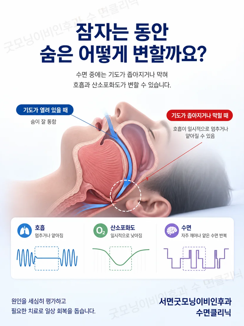 두피 전극과 모발 사이의 접촉 원리 설명