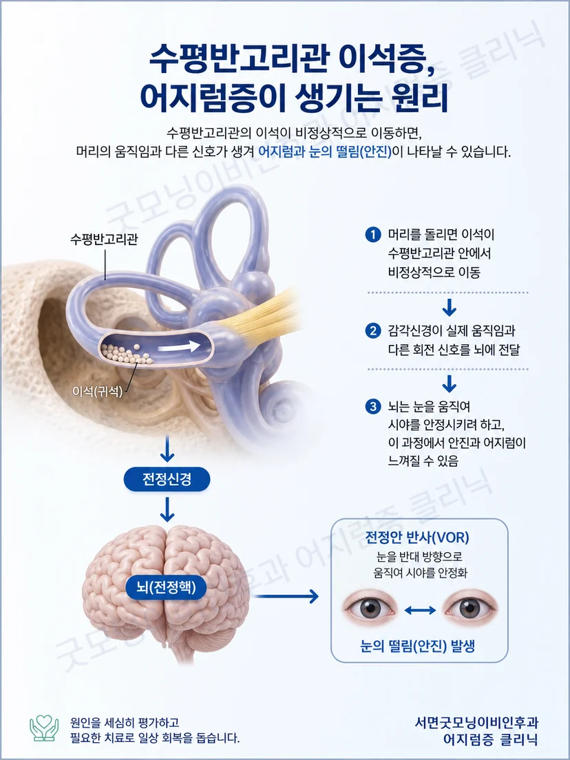 다축 회전으로 수평반고리관의 자세를 재현하는 TRV Chair 원리 도식