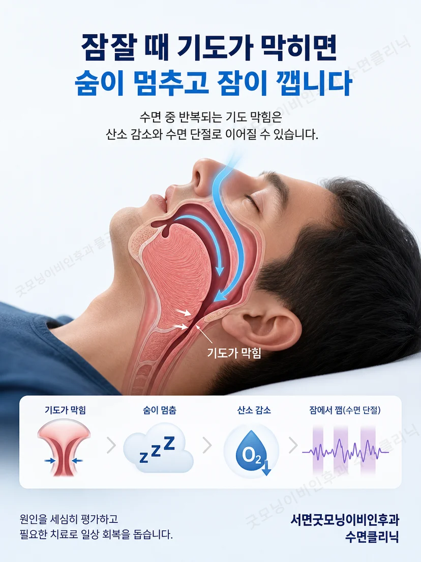 양압기 본체와 호스 및 얼굴 마스크가 연결된 구조