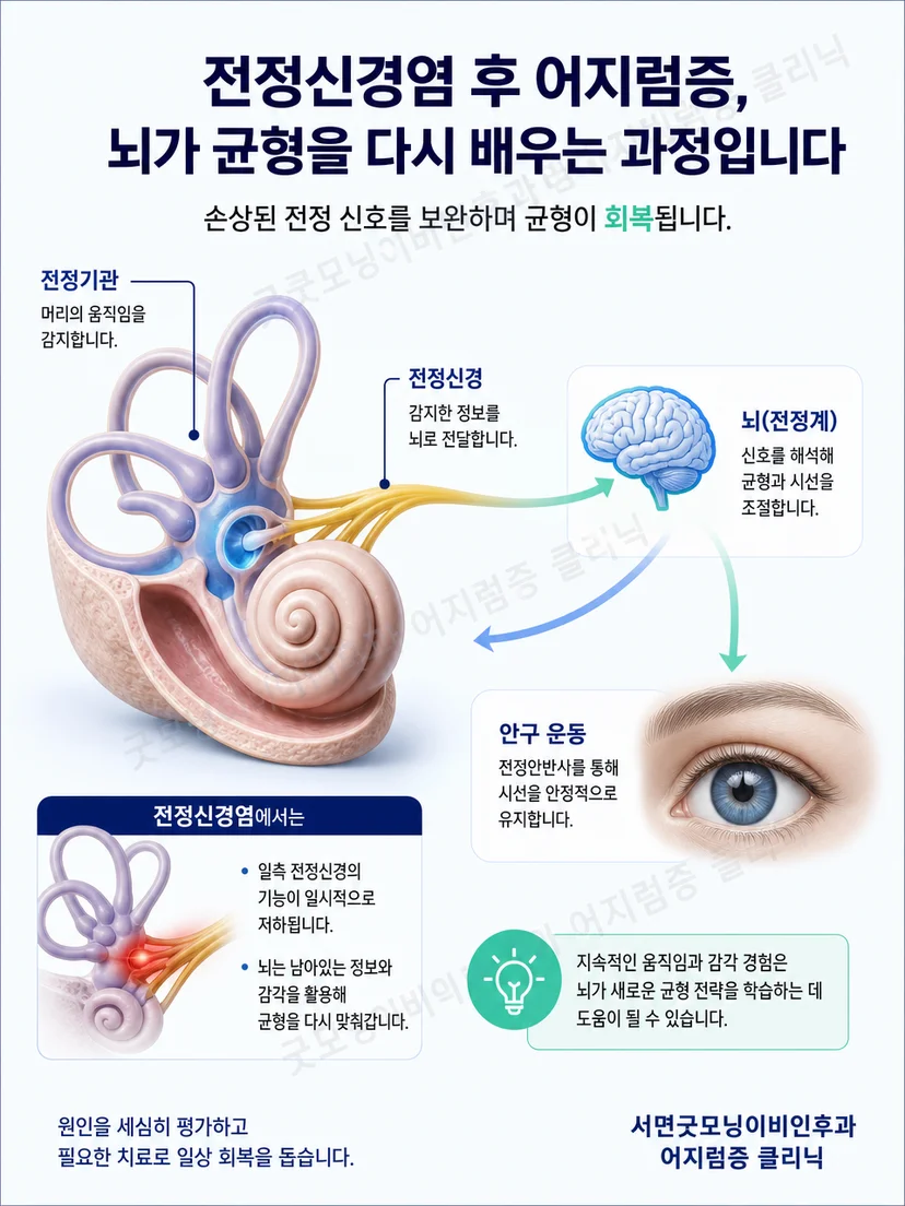 한쪽 전정기능 저하 이후 시선과 균형이 적응하는 원리