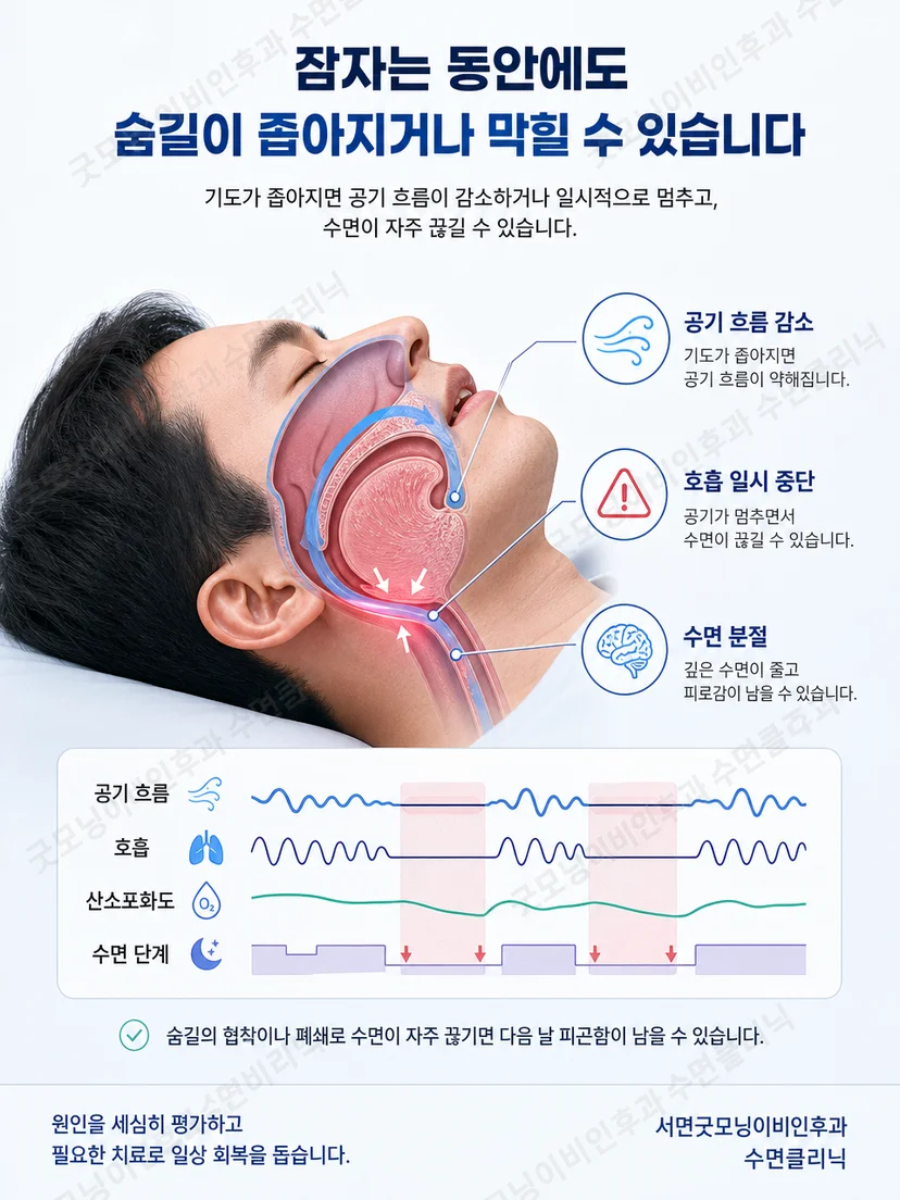 침대와 각성의 연관이 형성되는 과정을 나타낸 이미지
