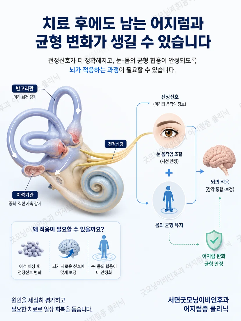 시각과 전정감각 및 자세 조절의 상호작용을 설명하는 이미지