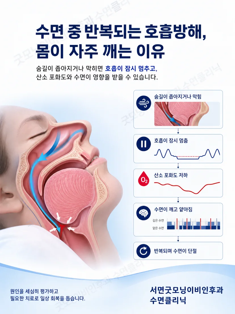 말초신경의 감각 전달과 다리 불편감의 차이를 설명하는 이미지