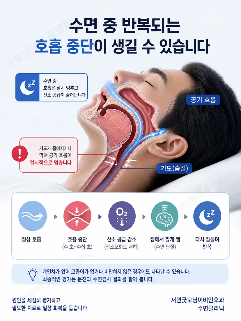 수면 중 턱 근육 움직임과 상기도 호흡 변화를 구분한 설명