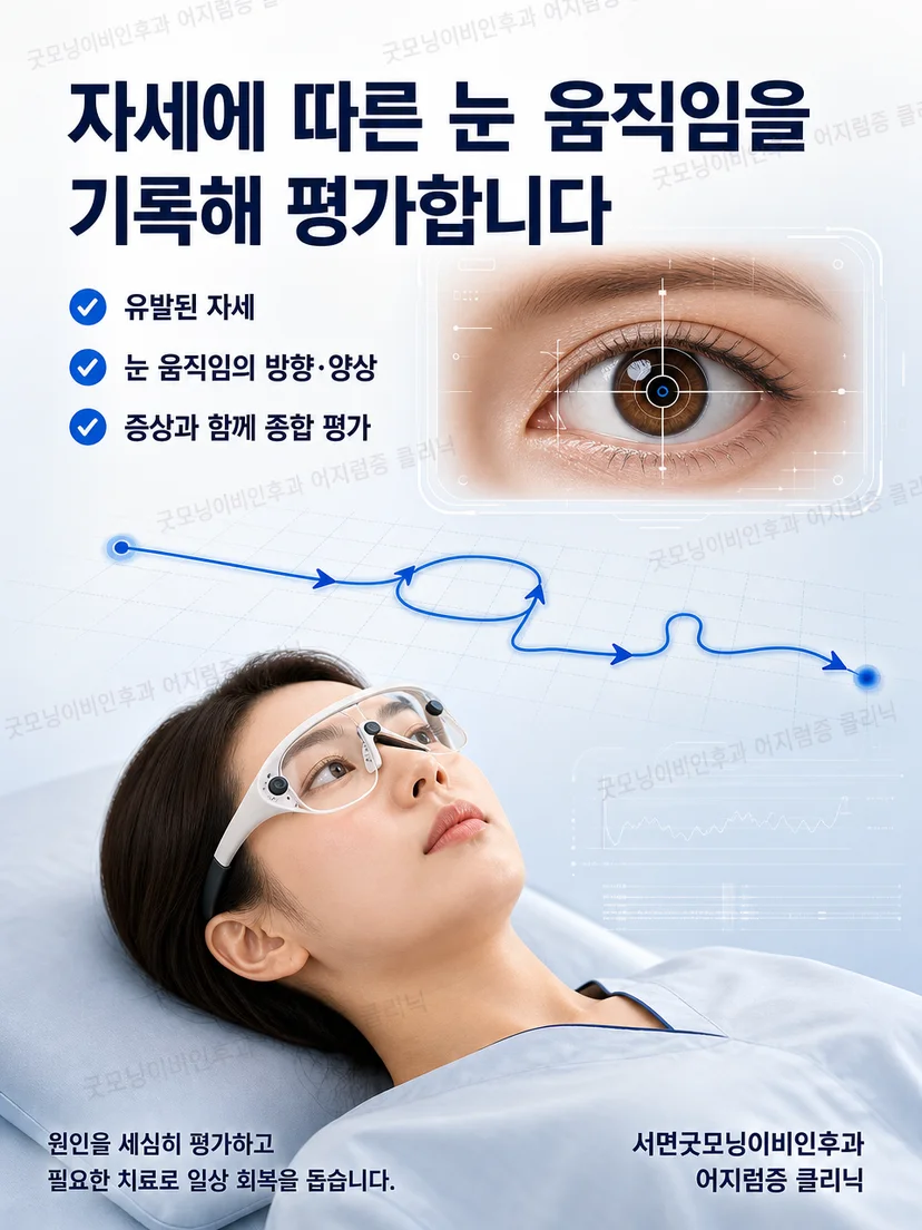 의료진이 자세검사 중 눈 움직임과 안진 방향을 관찰하는 평가 개념