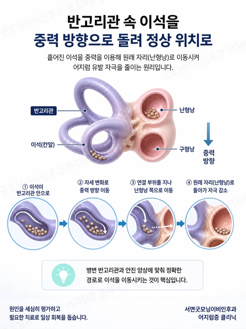 반고리관 안의 이석이 중력 방향을 따라 이동하는 정복 원리