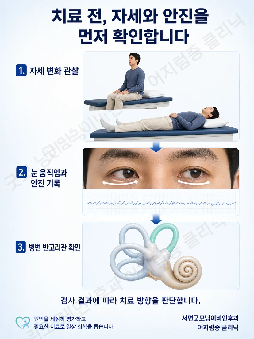 치료 전 자세검사와 안진 기록으로 병변 반고리관을 확인하는 흐름