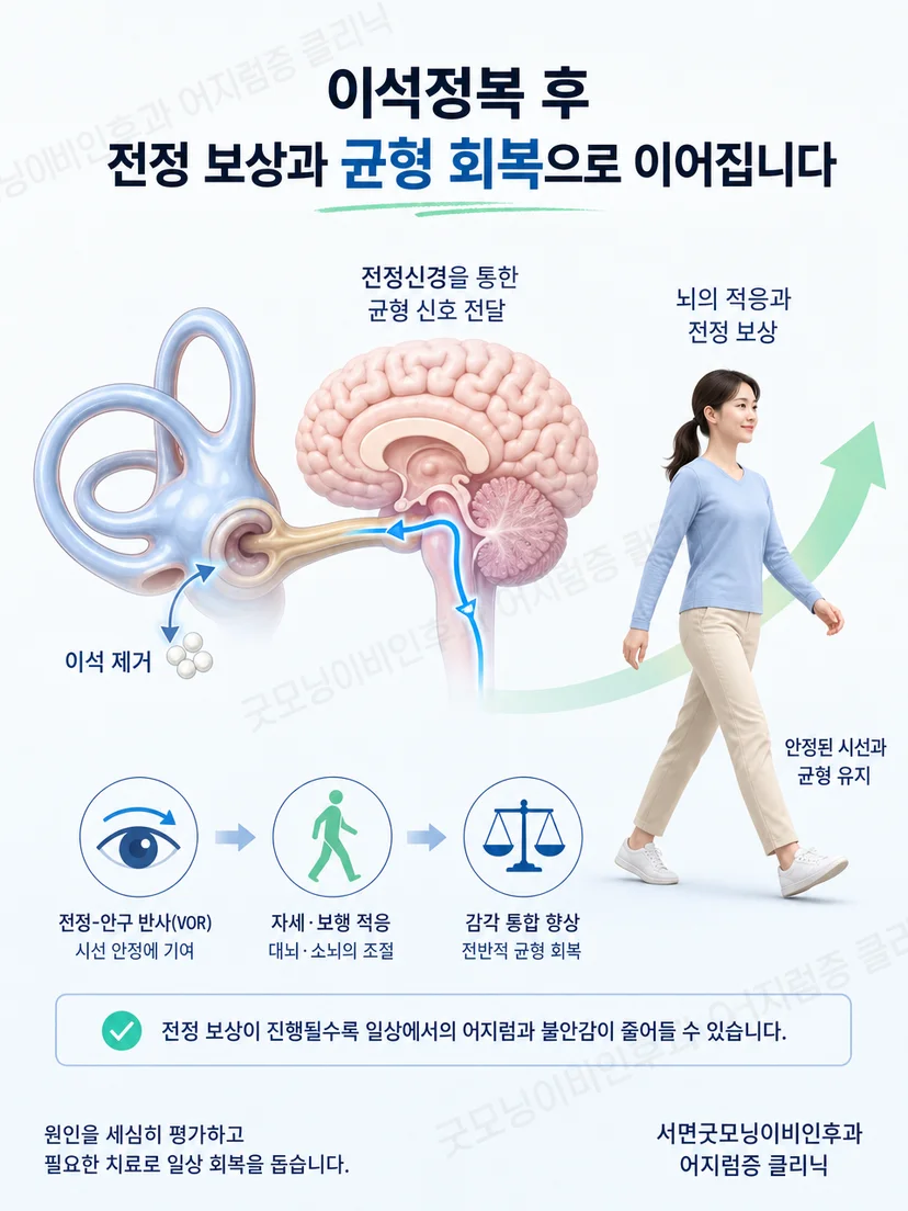 이석정복 이후 전정 보상과 균형 회복이 이어지는 개념