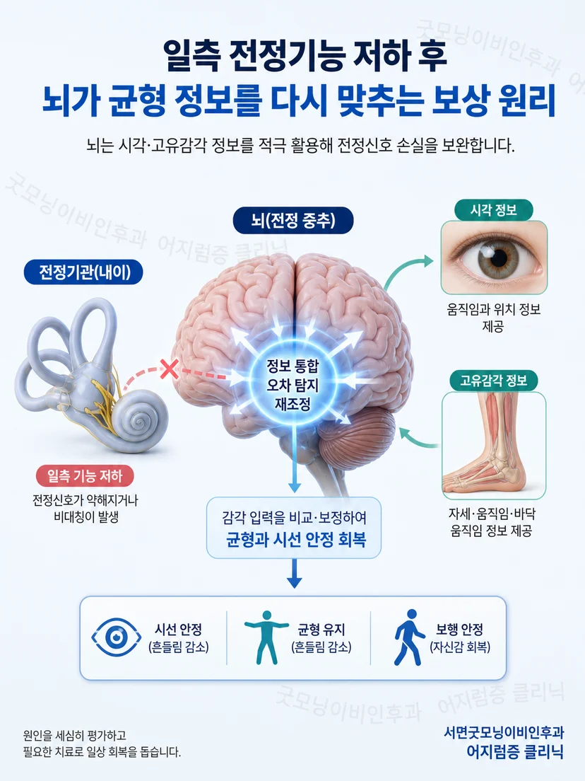 일측 전정기능저하 후 시각과 고유감각을 재조정하는 전정 보상 원리