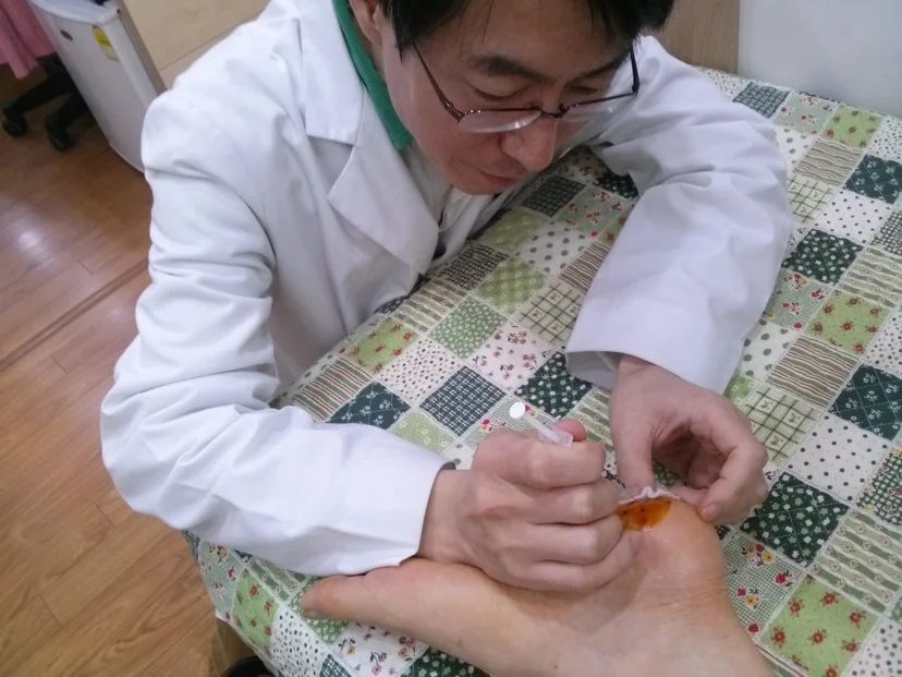 deep venom therapy