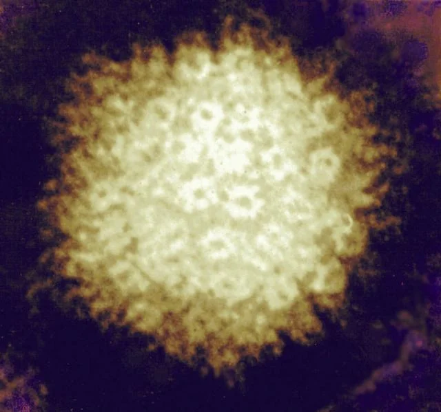 microscopic Zoster virus