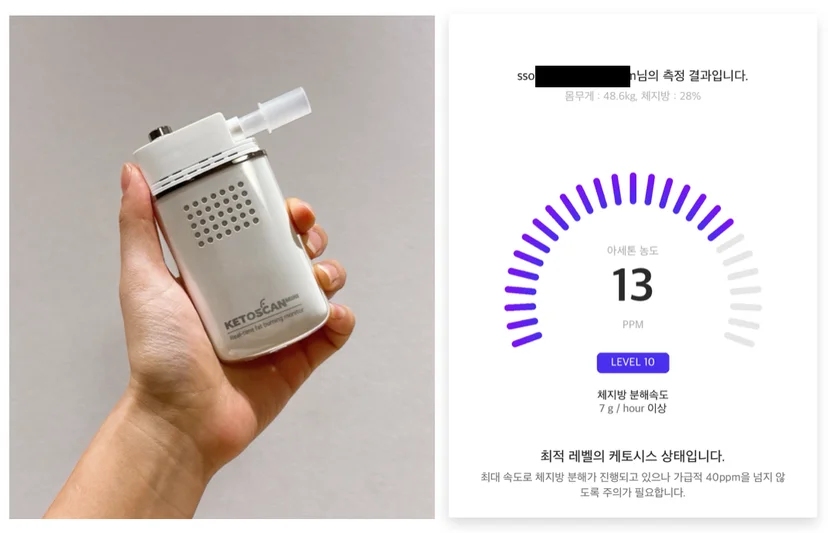 키토다이어트 케톤스캔 케토시스 키토다이어트