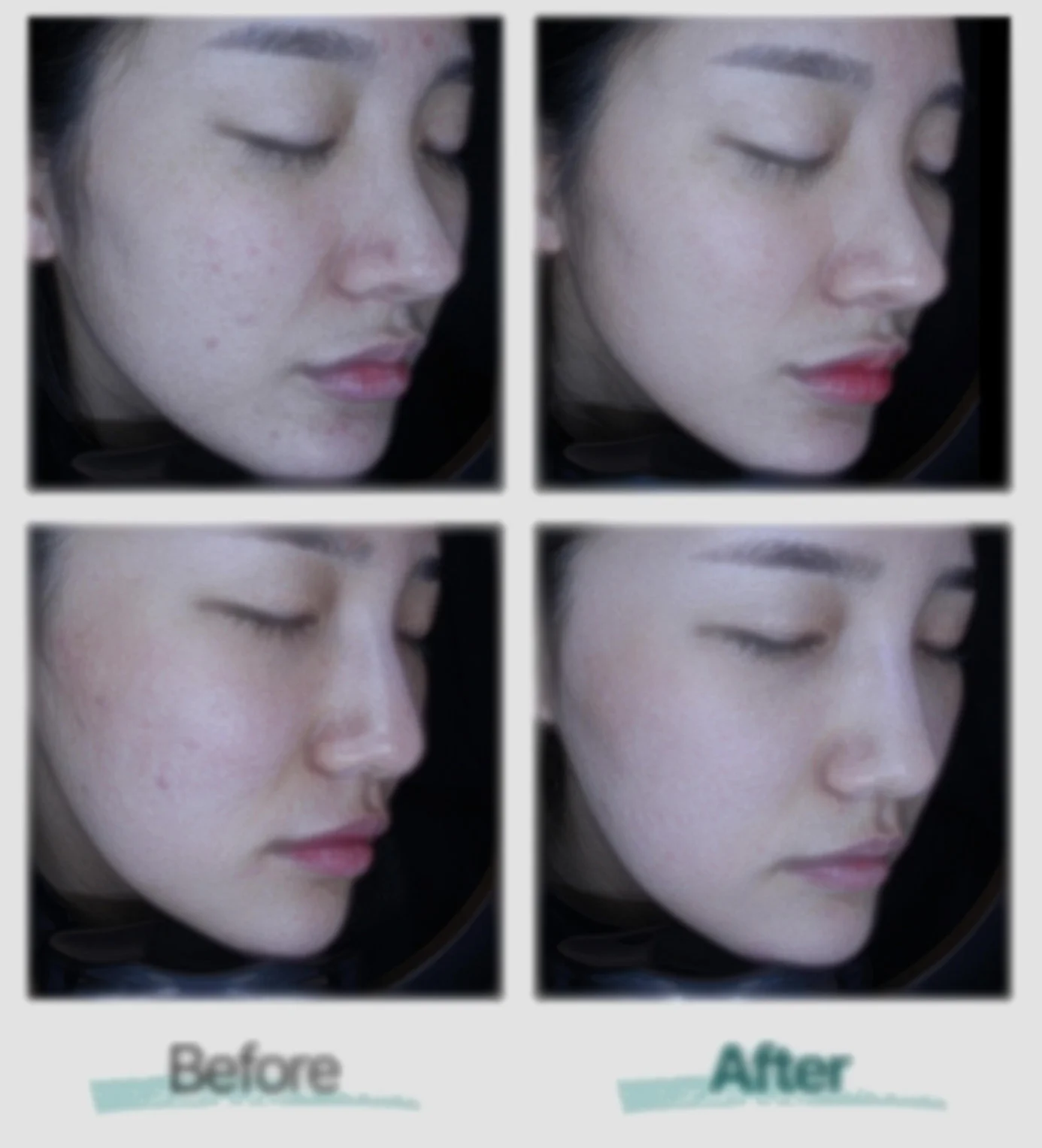 상세페이지-기획-필수-요소-before-after1