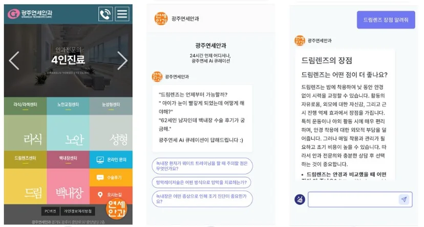 안과 마케팅 ai