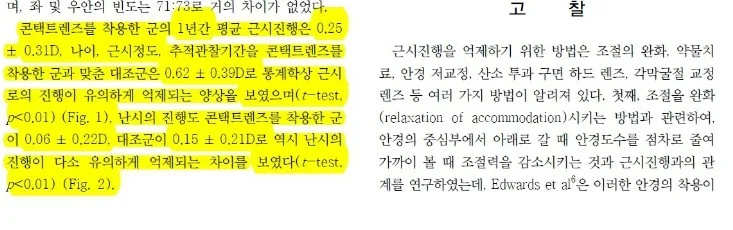 광주연세안과 드림렌즈