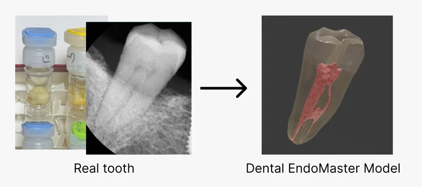 Real tooth transformed into a Dental EndoMaster model