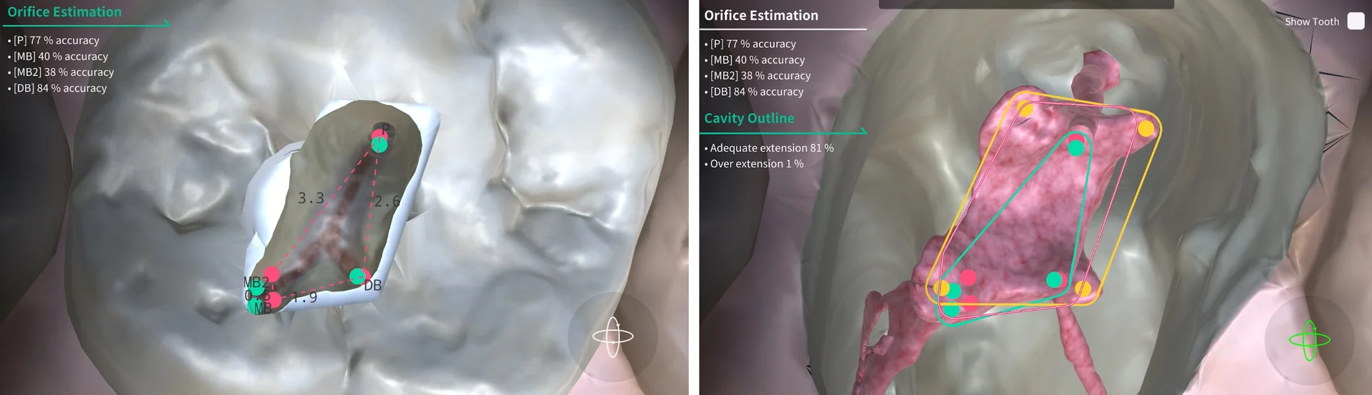 The trainee's predicted landmarks are displayed in 3D alongside the actual landmarks, offering various perspective views.