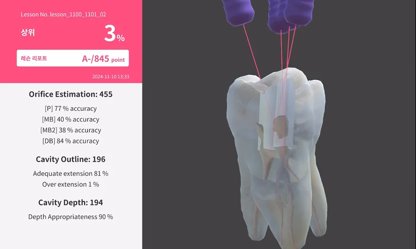 The lesson report screen provides a structured report on the results of cavity preparation.