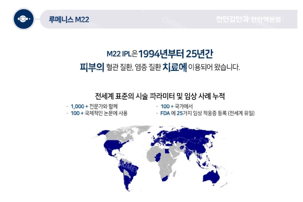 천안 안구건조증