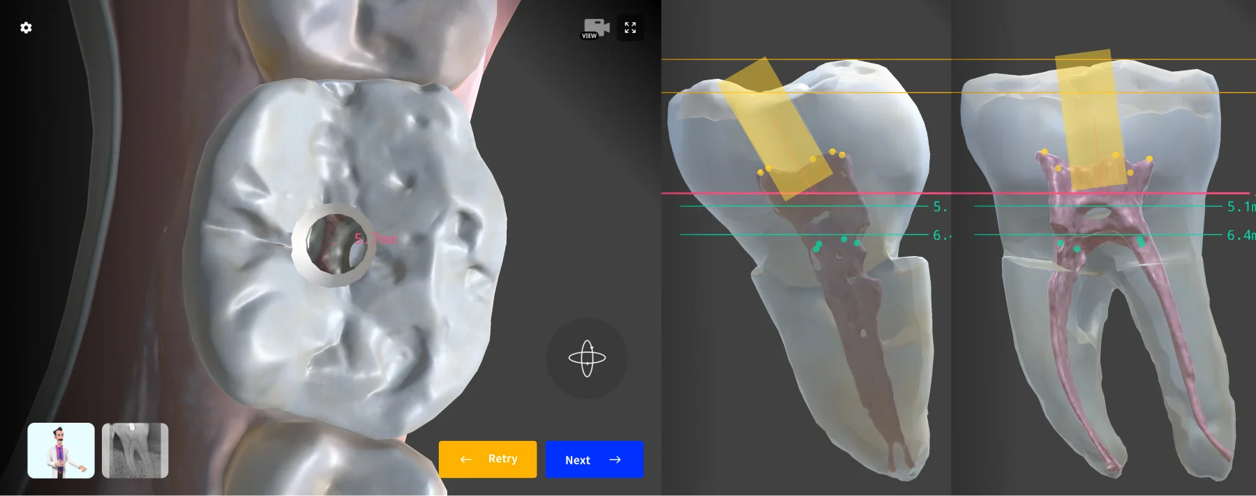 Starting from the Central Pit
