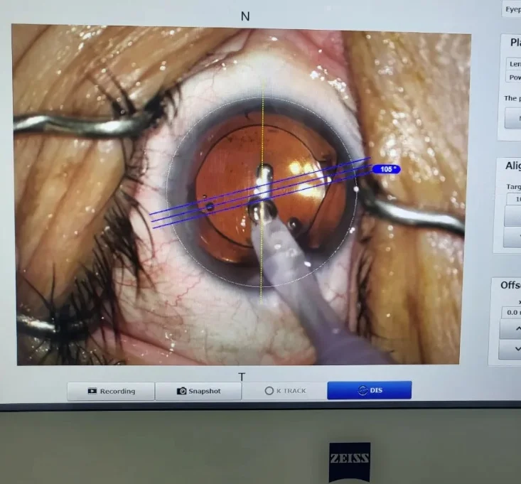 천안김안과 백내장