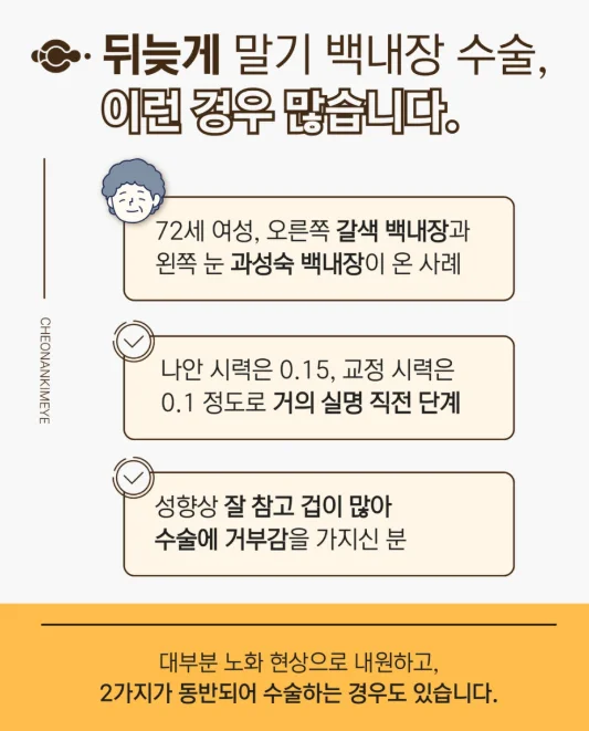 고난이도 백내장