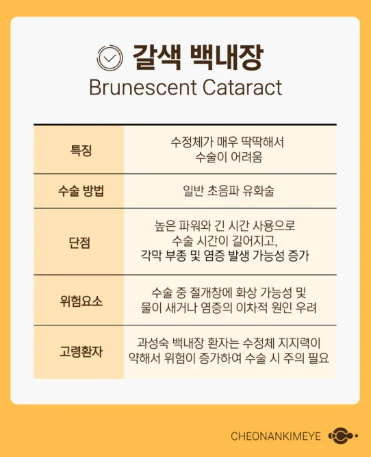 갈색 백내장