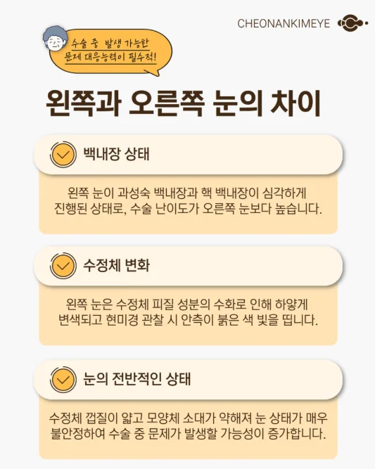고난이도 백내장