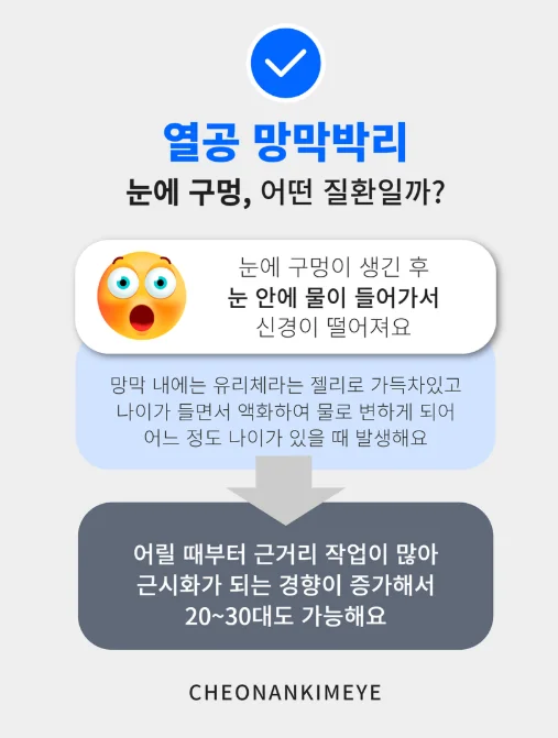 천안 열공 망막박리