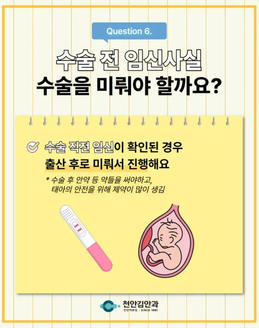 천안 임신 시력교정수술