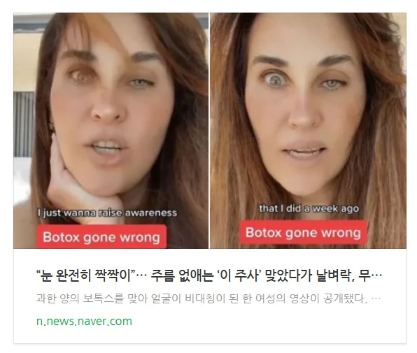 보톡스 주사