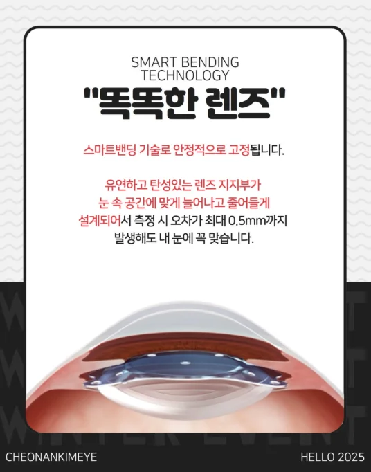 천안 안내렌즈삽입술