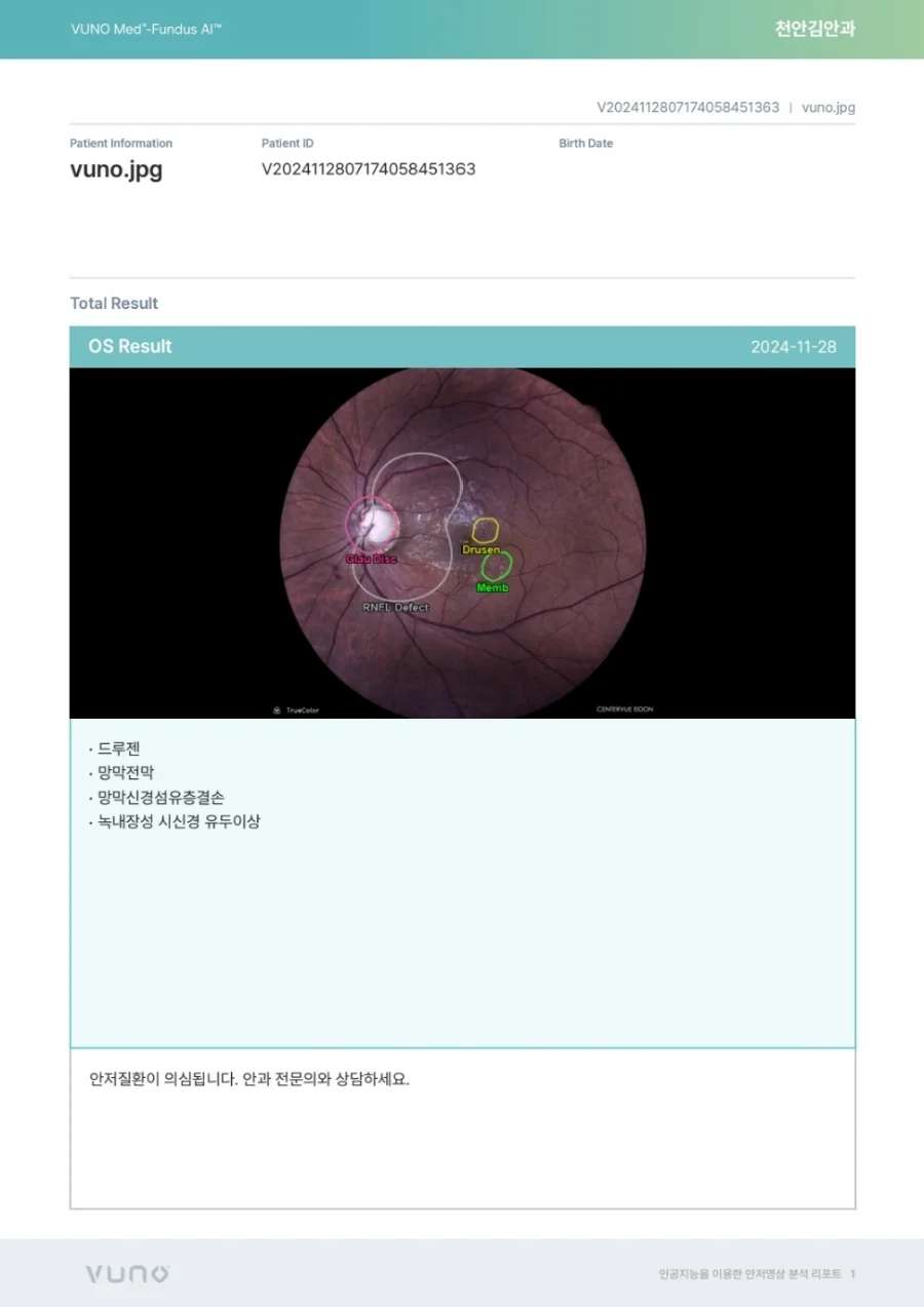 천안김안과 뷰노AI 실제사례