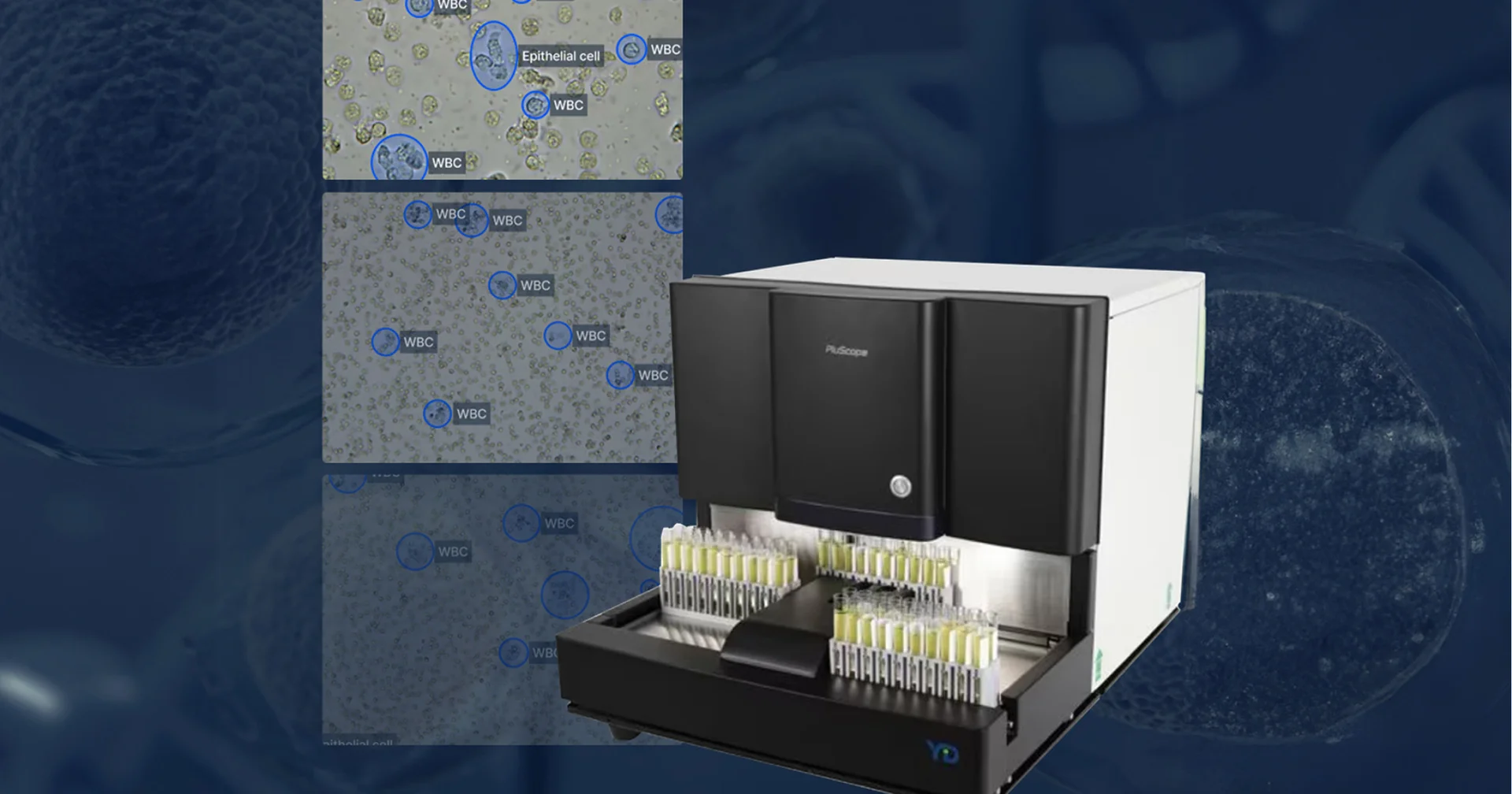이미지 분석 작동 원리