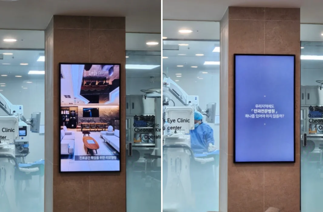 천안 백내장 수술 시기 결정