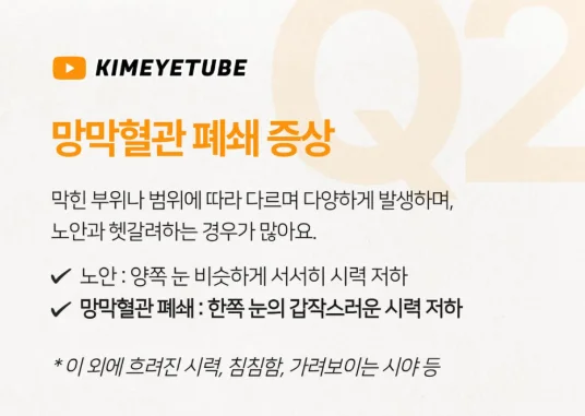천안 망막