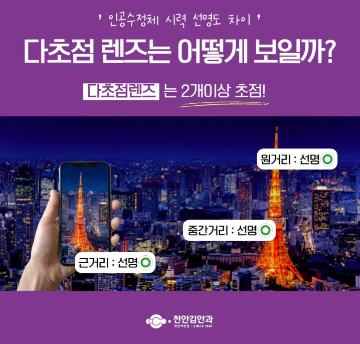 천안 다초점 백내장