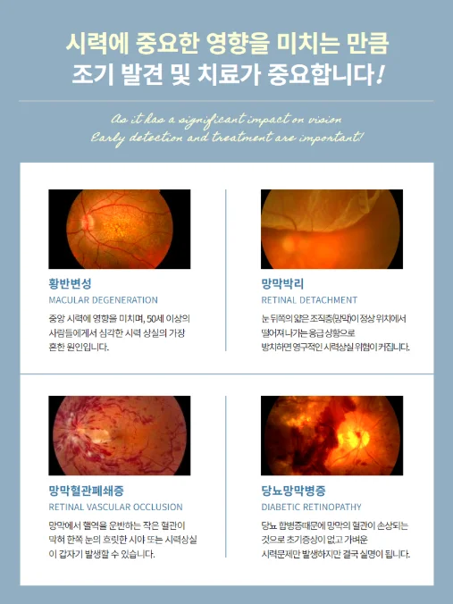 천안 망막박리