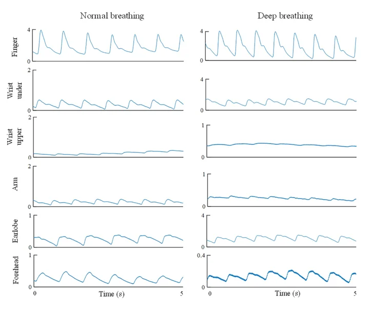슬립트래커 착용 부위에 따라 PPG의 정확도에 차이가 난다. 손가락과 손목에 착용했을 시 비교적 정확한 것을 발견할 수 있다.