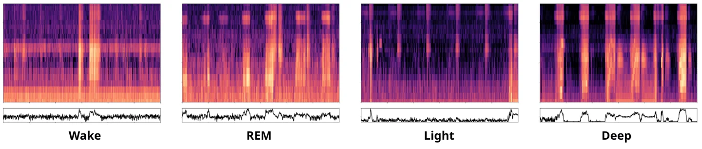 호흡 패턴의 규칙성을 통해 수면 단계를 파악할 수 있다.