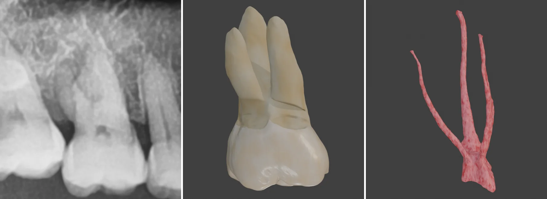 Radiographic images and 3D models of tooth root canals