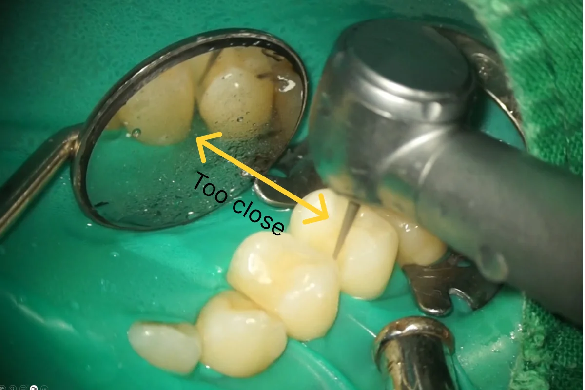 The dental mirror is too close to the operating site, causing water spray to splash onto it.