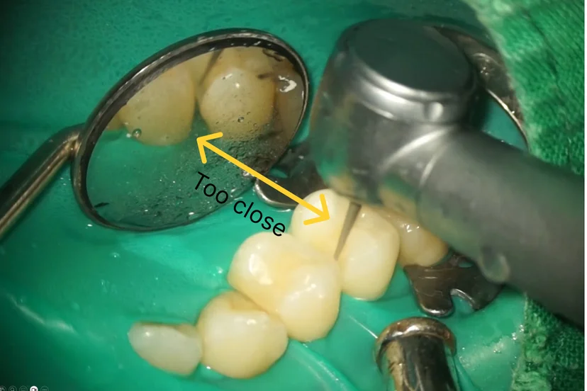 The dental mirror is too close to the operating site, causing water spray to splash onto it.