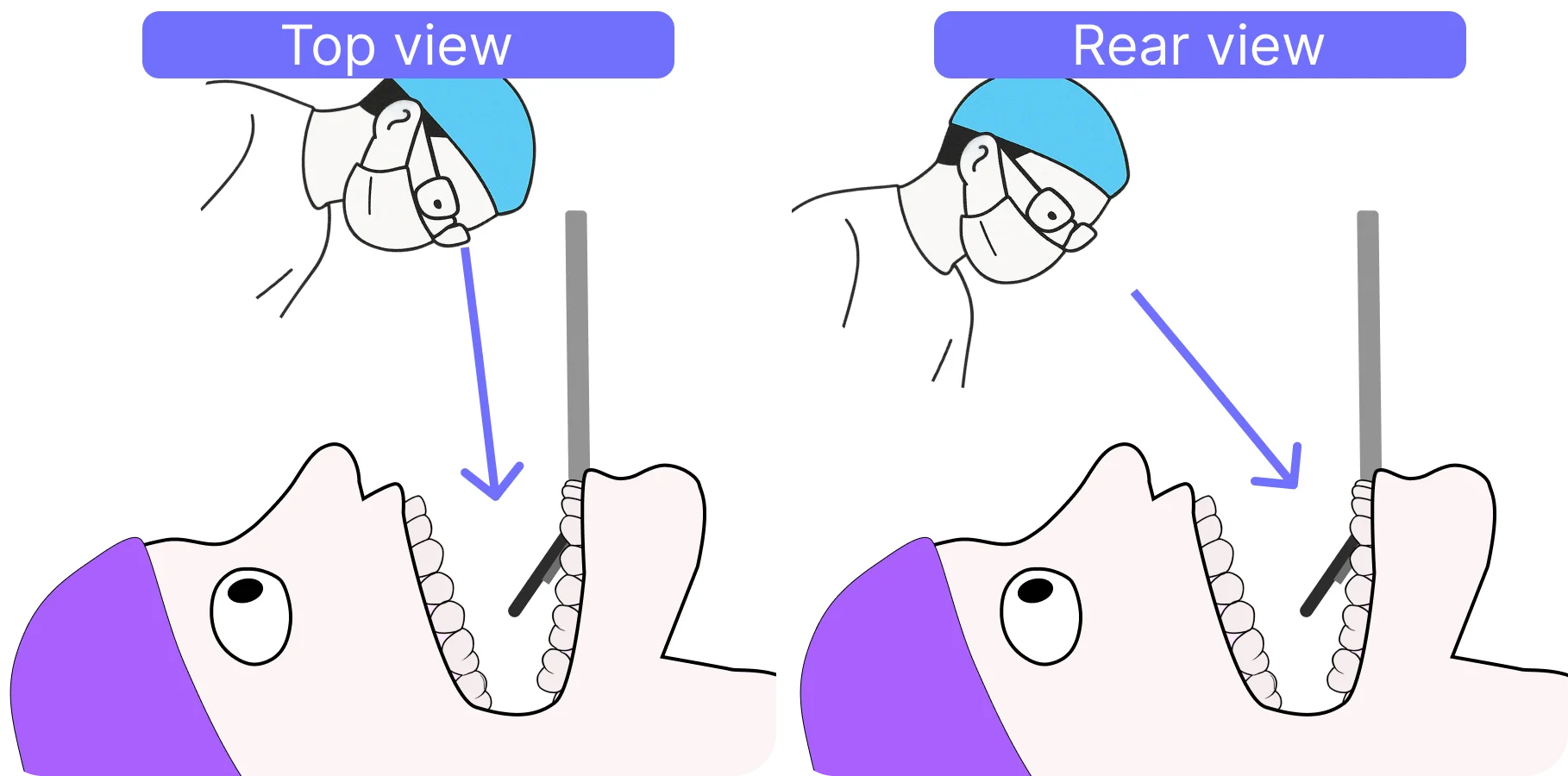 Maxilla indirect vision