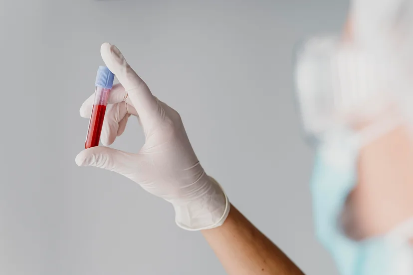 Liquid Biopsy