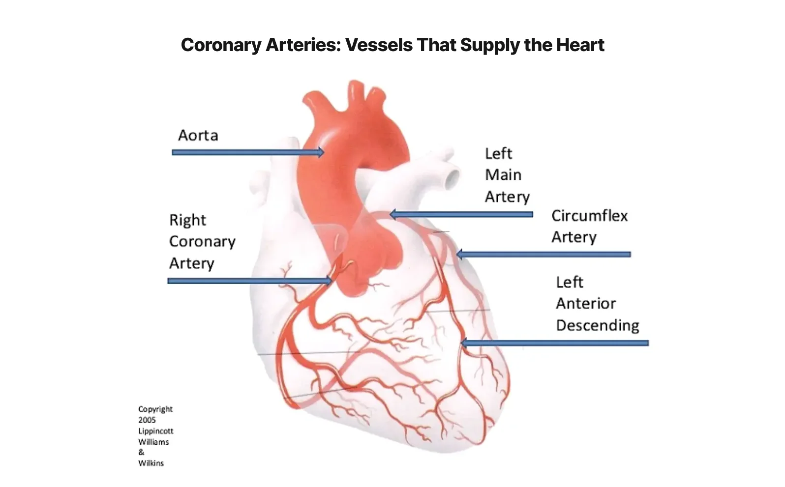Anatomical diagram of coronary arteries showing major vessels that supply blood to the heart including the aorta, left main artery, circumflex artery, right coronary artery, and left anterior descending artery