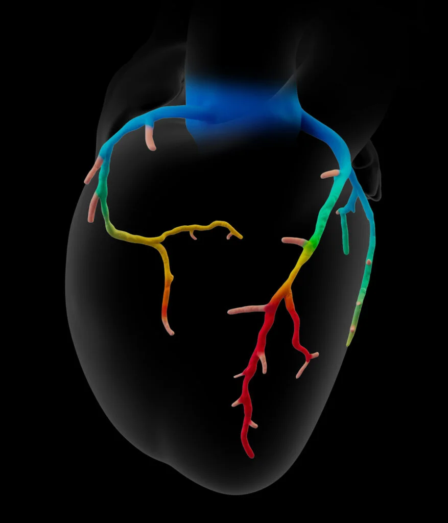 3D rendered heart model with color-coded coronary arteries showing the complete coronary circulation system in different colors against a black background