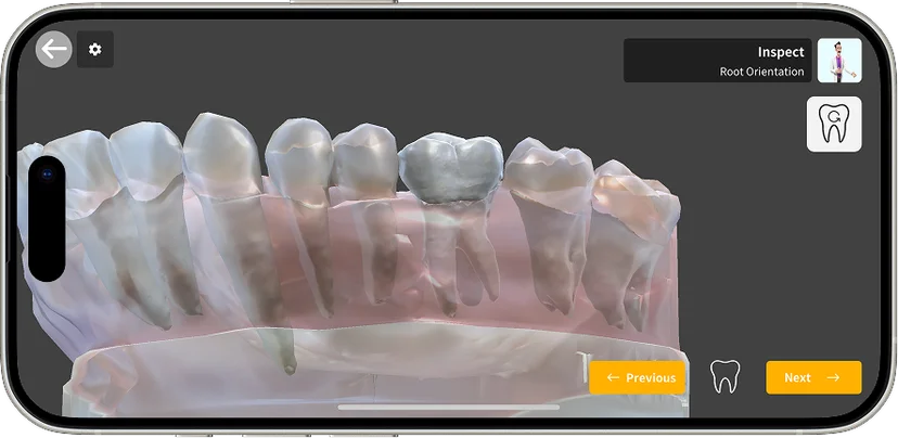 Root orientation visualized within the dental arch.