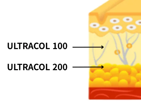 Injection Depth Comparison – UltraCol 100 vs 200